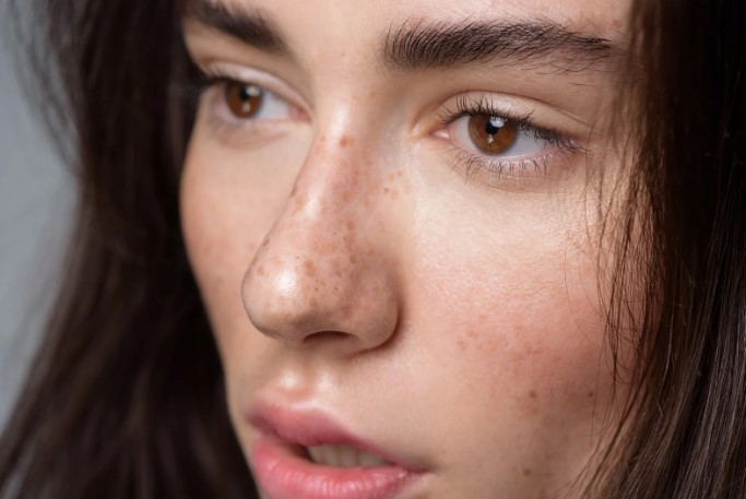 Диагностика безопасности родинок Диагностика безопасности родинок